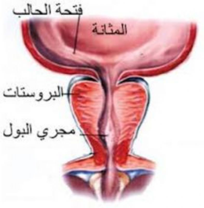 اعراض مرض البروستاتا وعلاجه - تجنب التهاب البروستاتا 5599 1