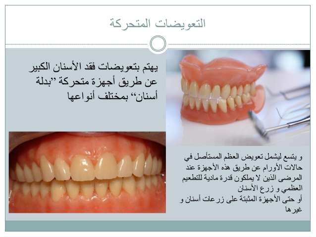 معلومات عن طب الاسنان - علوم الطب المختلفة 5644 4