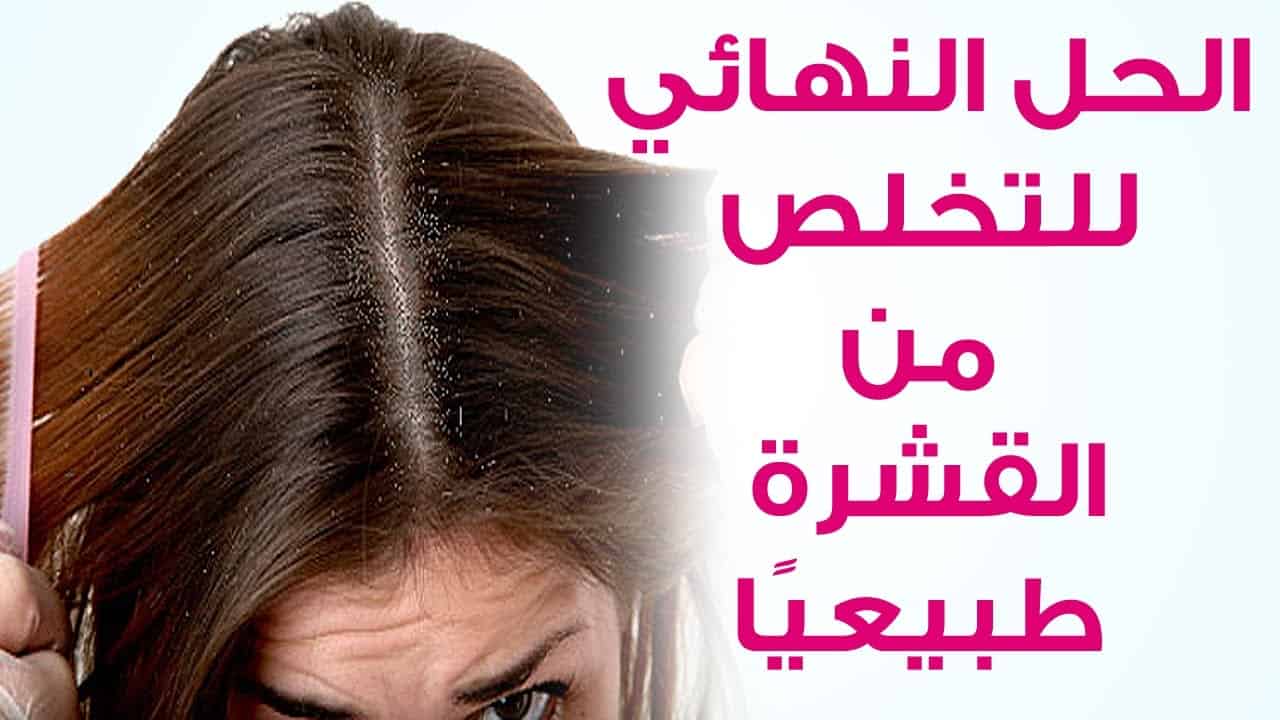 ازالة قشرة الراس , القشره وطريقه التخلص منها فى الراس