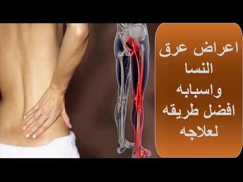 عرق النسا بالصور , الالام الوركية التي تصيبك