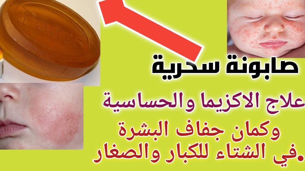 علاج اكزيما الوجه , اهراض وعلامات وعلاج اكزيما جلد الوجه